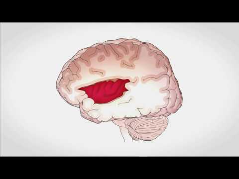 piensa con la mente no con el corazón