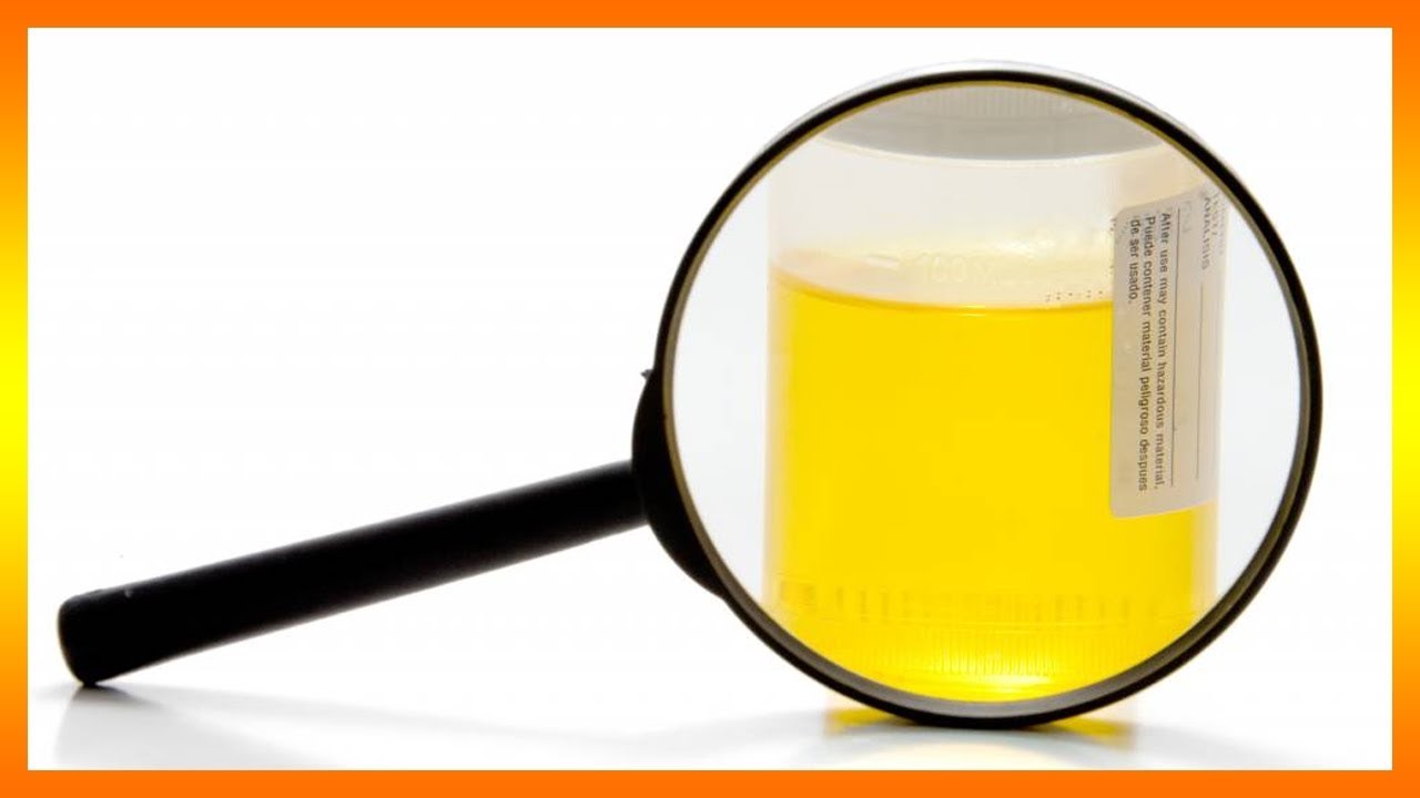 soñar con orina de perro